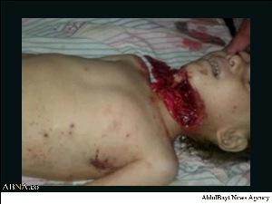 کودکان در سوریه برای منافع اسرائیل کشته می شوند