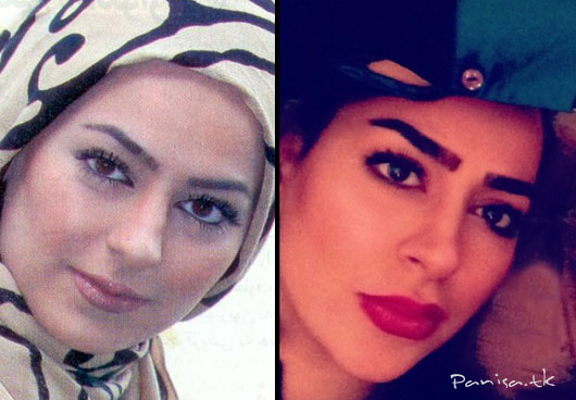 عکسهای قبل و بعد از عمل سمانه پاکدل!