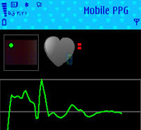 کنترل ضربان قلب با Biophotonics Mobile PPG v1.2 برای نوکیا سری ۶۰ ورژن ۳
