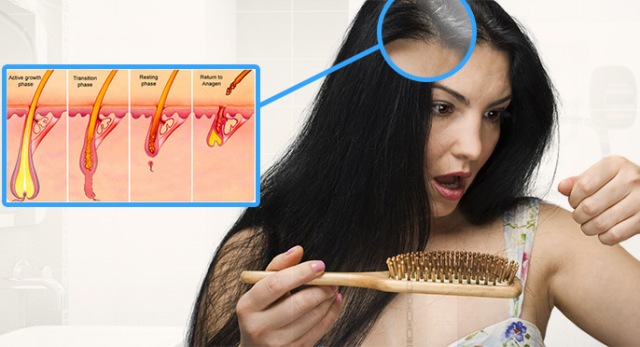 درمان ریزش مو ناشی از کم کاری تیروئید