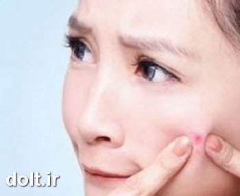 چگونه جوش های زیر پوستی را از بین ببریم ؟