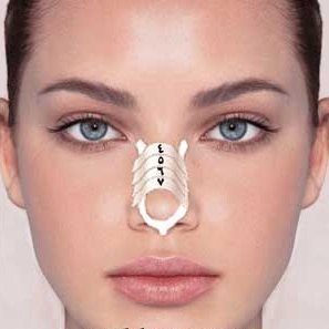 چسب زدن به بینی بعد از عمل