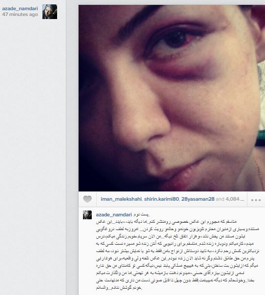 ماجرای عکس صورت کبود و کتک خورده آزاده نامداری در اینستاگرام