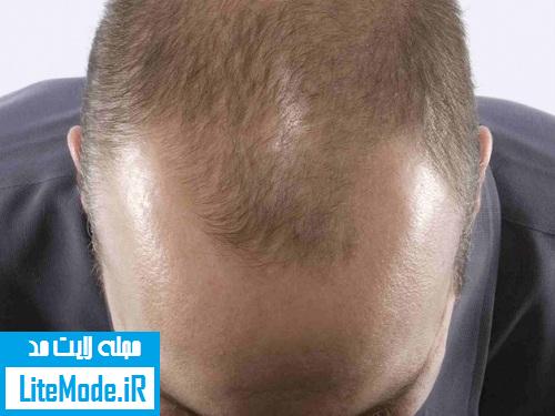 The main causes of hair loss and ways to detect and treat