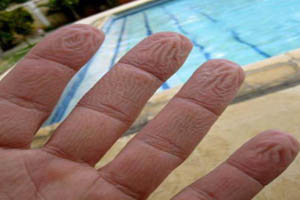 علت چروک شدن انگشتان بعد حمام و استخر چیست؟