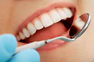 داروهایی که موجب پوسیدگی دندان می شود