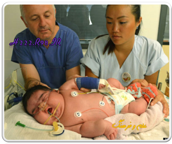 تولد غول پیکرترین نوزاد دنیا + عکس!