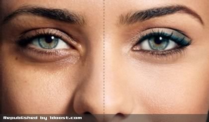 درمان سیاهی دور چشم با طب سنتی