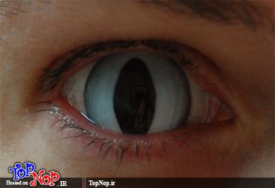 عجیب ترین لنز های چشم به روایت تصویر,عکس های لنز چشم عجیب و غریب,عجیب ترین لنز های چشم,لنز چشم طرح دار,لنز
