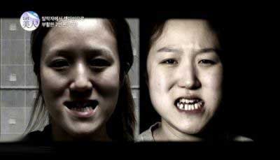 عکس های قبل و بعد عمل زیبایی باورنکردنی این دو خواهر زشت,عمل زیبایی دو خواهر زشت کره ای,عمل زیبایی دختران کره ای,عکس های قبل و بعد عمل های زیبایی دختران کره ای,تصاویر عمل زیبایی دو خواهر کره ای