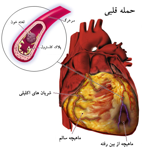 خواص شگفت انگيز و فراوان زردچوبه