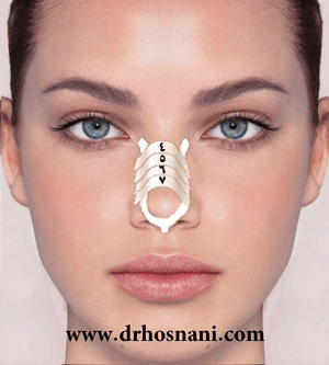 تصویر: https://rozup.ir/up/rhinoplasty-info/nose-taping-method2.png