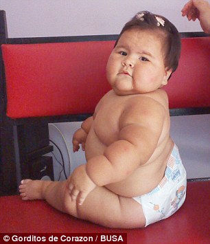 چاق ترین کودک به دنیا امده در دنیا