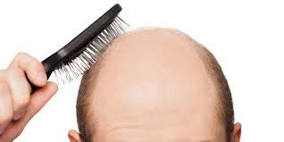 ماسک خانگی برای درمان ریزش مو 