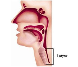 لارنژیت حاد ( Acute laryngitis ) یا التهاب حنجره