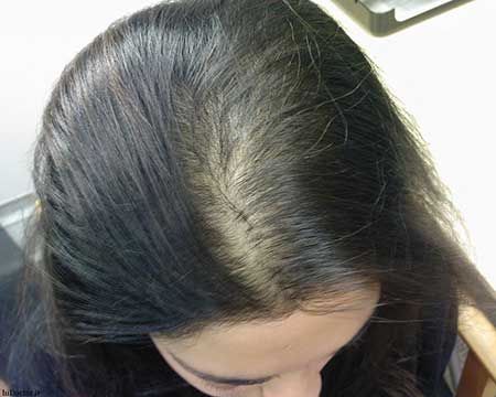 تقویت و بر شدن موی سر با مواد طبیعی