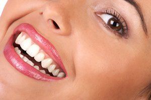 4روش طبیی برای سفید شدن دندان ها
