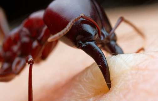 لحظه گاز گرفتن مورچه از انسان+عکس