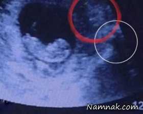 شیطان داخل شکم این زن باردار زندگی می کند! + تصاویر