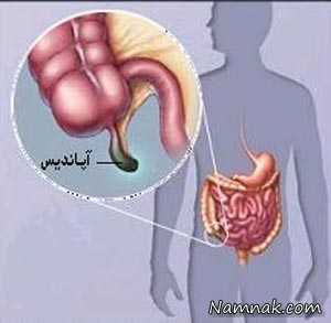 خاصیت آپاندیس در بدن کشف شد