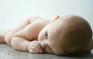 درمان سوختگی پوشک بچه
