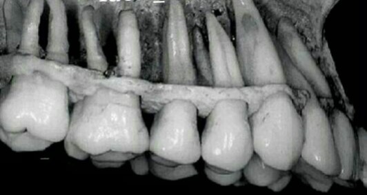 عکس دندان های انسان بالغ به طور کامل