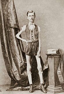 آیزاک اسپراگ (1841-1887) مرد لاغری که در قرن 19 به اسکلت متحرک مشهور بود! 