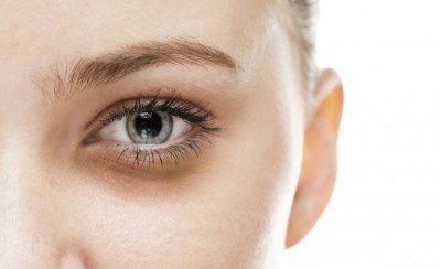 علائم و درمان آلرژی ها و حساسیت های چشم