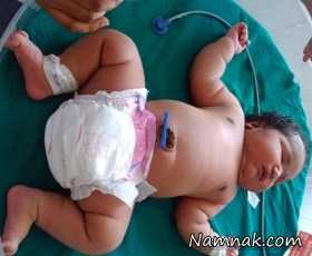 عکس بچه غول ، سنگین ترین زن دنیا متولد شد