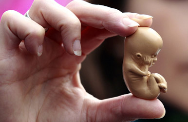 انواع سقط جنین و علایم و خطرات ناشی از سقط جنین 