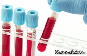 آزمایش خون و تشخیص مهم ترین مشکلات و بیماری ها