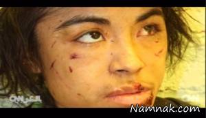 شکنجه وحشیانه دختر فراری که بردگی می کرد + تصاویر
