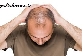 علل و جلوگیری از ریزش موی مردان