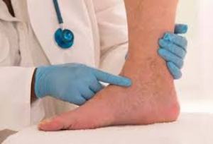 چگونه علایم پا را تشخیص دهیم