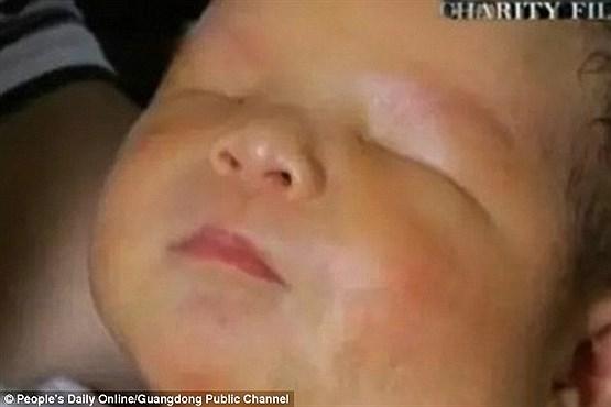 یک نوزاد بدون چشم در چین متولد شد (+عکس)