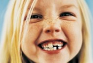 تمامی عوارض از دست دادن زودهنگام دندان های شیری برای کودکان