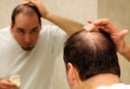 درمان و توقف ریزش موی سر در مردان به روش کاملا طبیعی