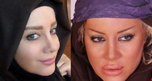 پشیمانی بازیگران زن از جراحی زیبایی بینی 