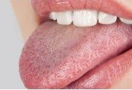 دلایل خشکی دهان، روش های طبیعی درمان