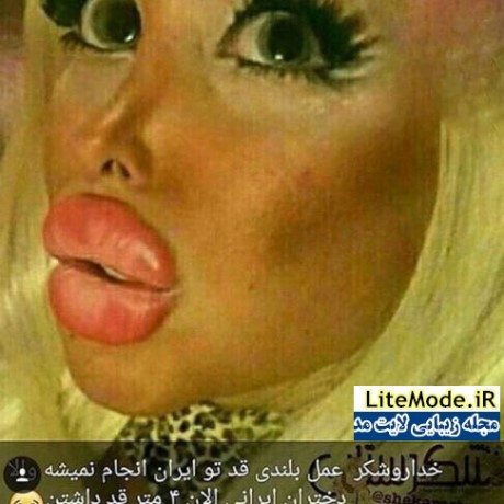 تمسخر جراحی زیبایی دختران توسط الهام عرب مدل ایرانی