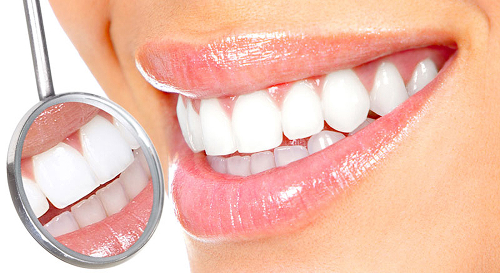 5 راه حل برای رفع زردی دندانها