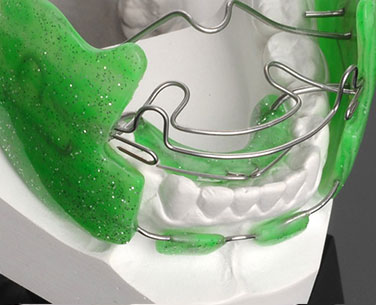 تفاوت دندانپزشک عمومی و متخصص ارتودنسی