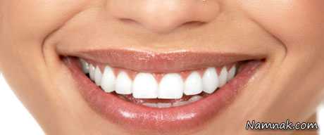 10 روش طبیعی برای سفید کردن دندانها