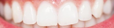 روشهای خانگی سفید شدن دندان