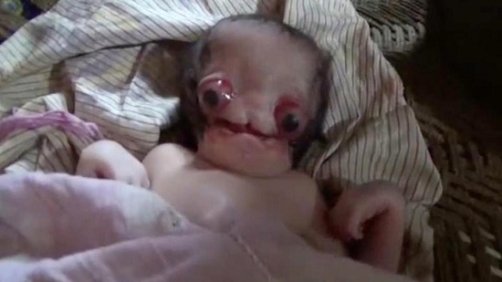 تولد نوزاد عجیب‌الخلقه شبیه به موجودات فضایی در هند+ تصاویر (۱۴+)
