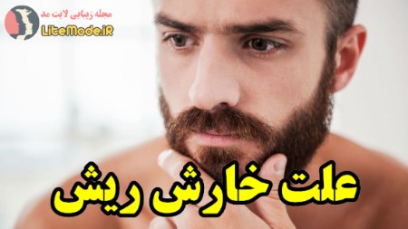 خارش ریش, مشکل خارش ریش در آقایان, علت خارش ریش ,درمان موثر برای خارش ریش, پیشگیری از خارش ریش مردان, 