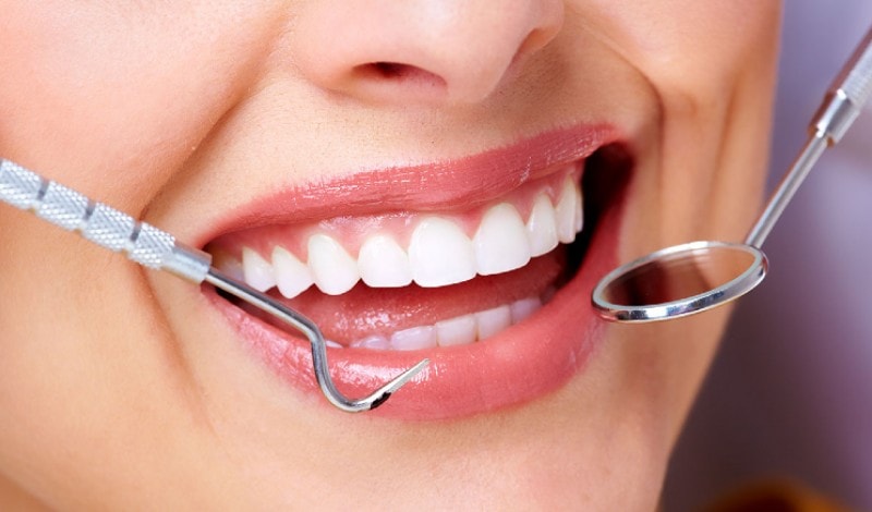 کشیدن دندان: علل و جراحی دندان عقل، هزینه، مراقبت پس از کشیدن