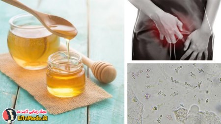 درمان عفونت واژن با عسل طبیعی