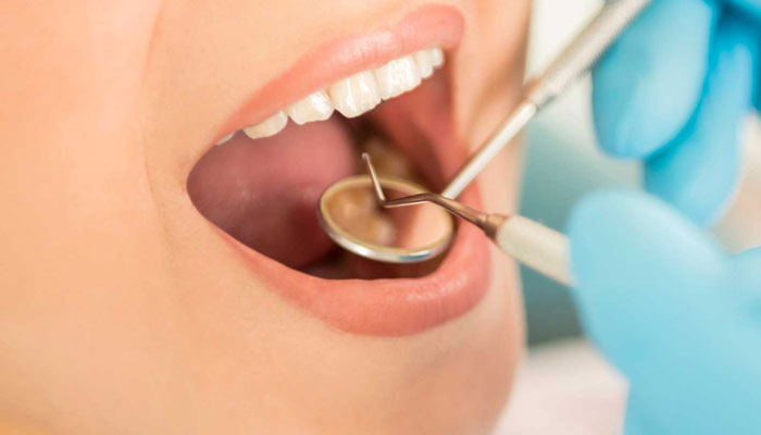 چهار راه ساده و طبیعی برای جلوگیری از پوسیدگی دندان
