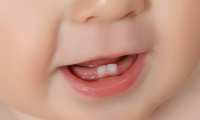دندان هاي نوزاد از چند ماهگي درمي آيند؟